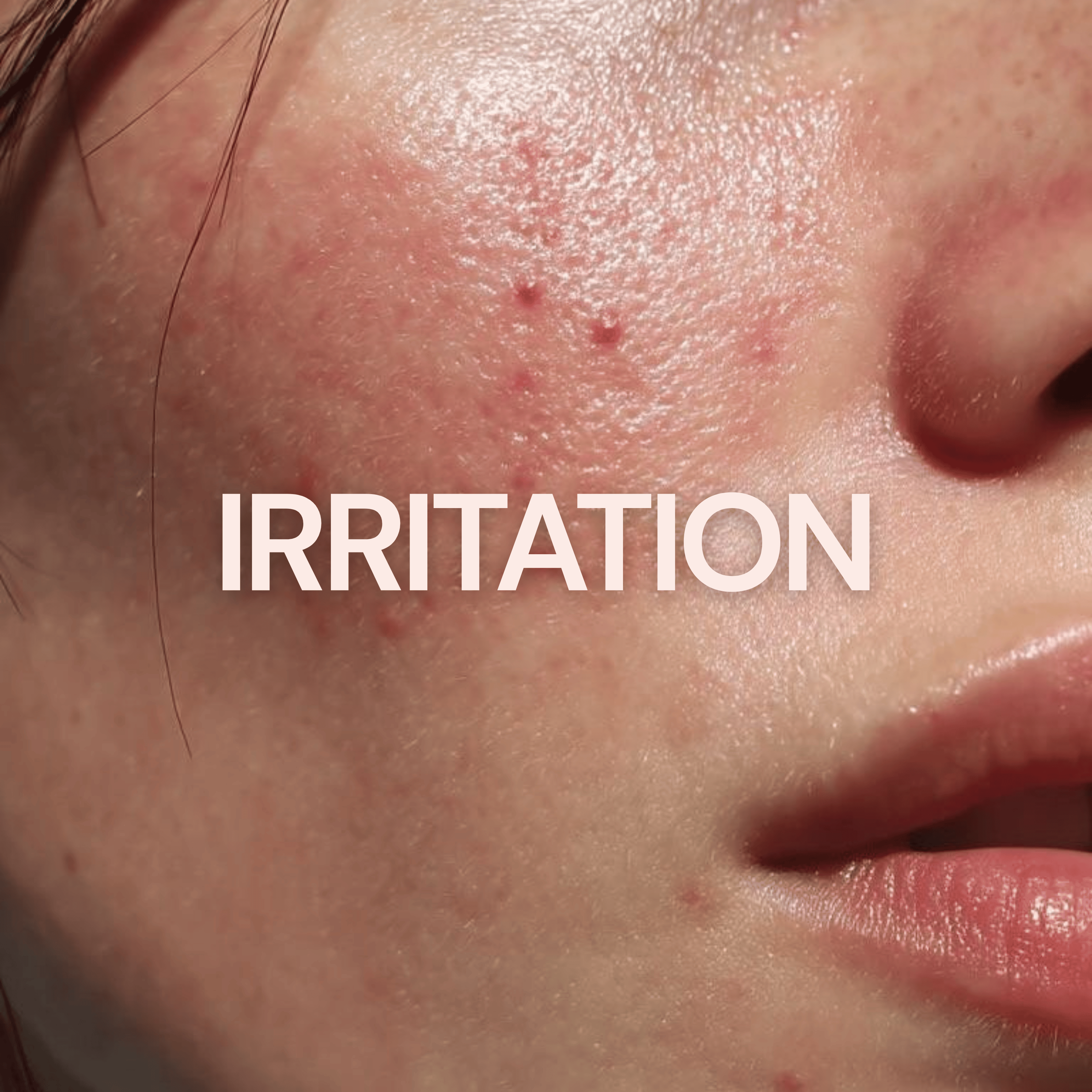 Buy Soothing Skincare for Irritated Skin Online - Root Labs