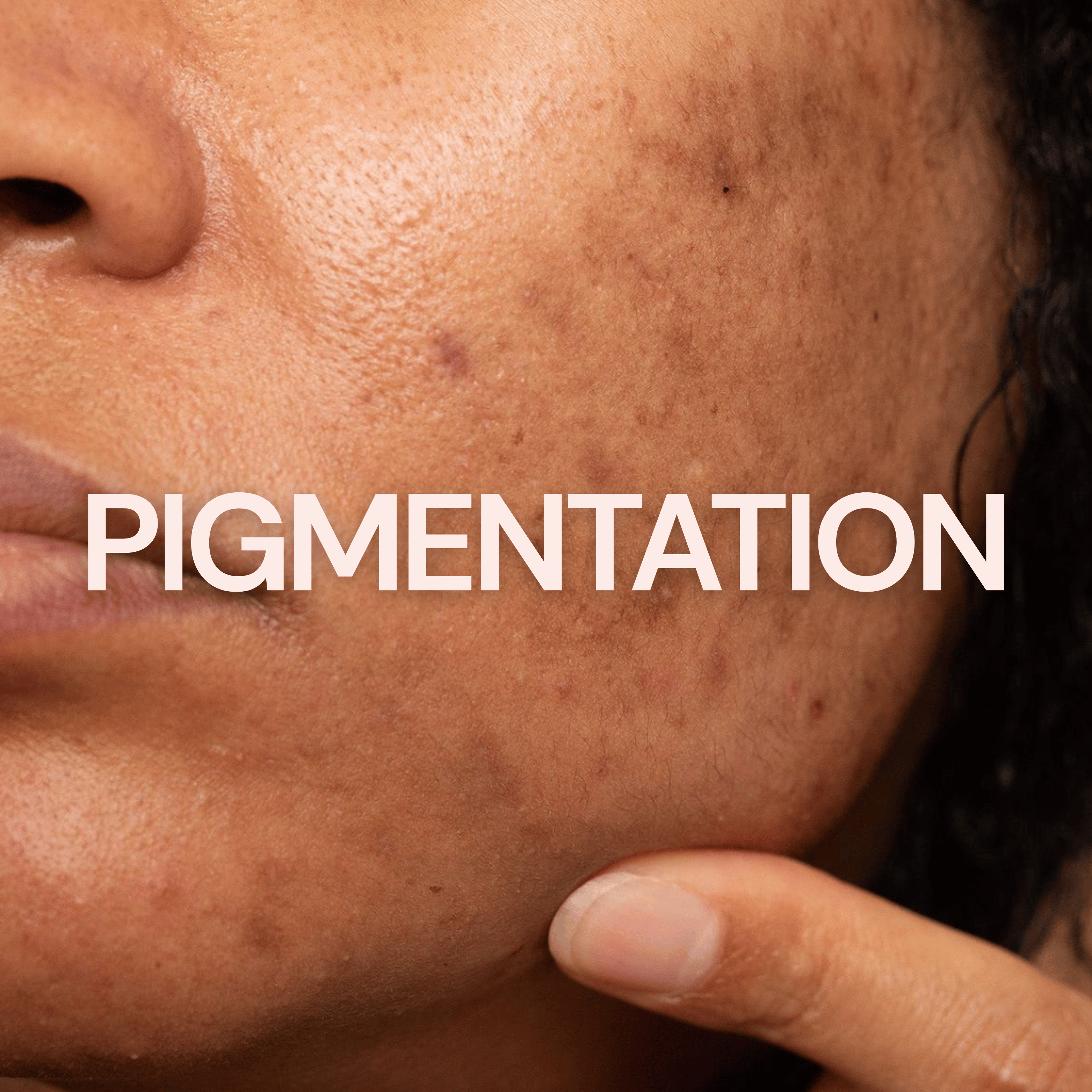 Buy Pigmentation Serum for Dark Spots Online - Root Labs