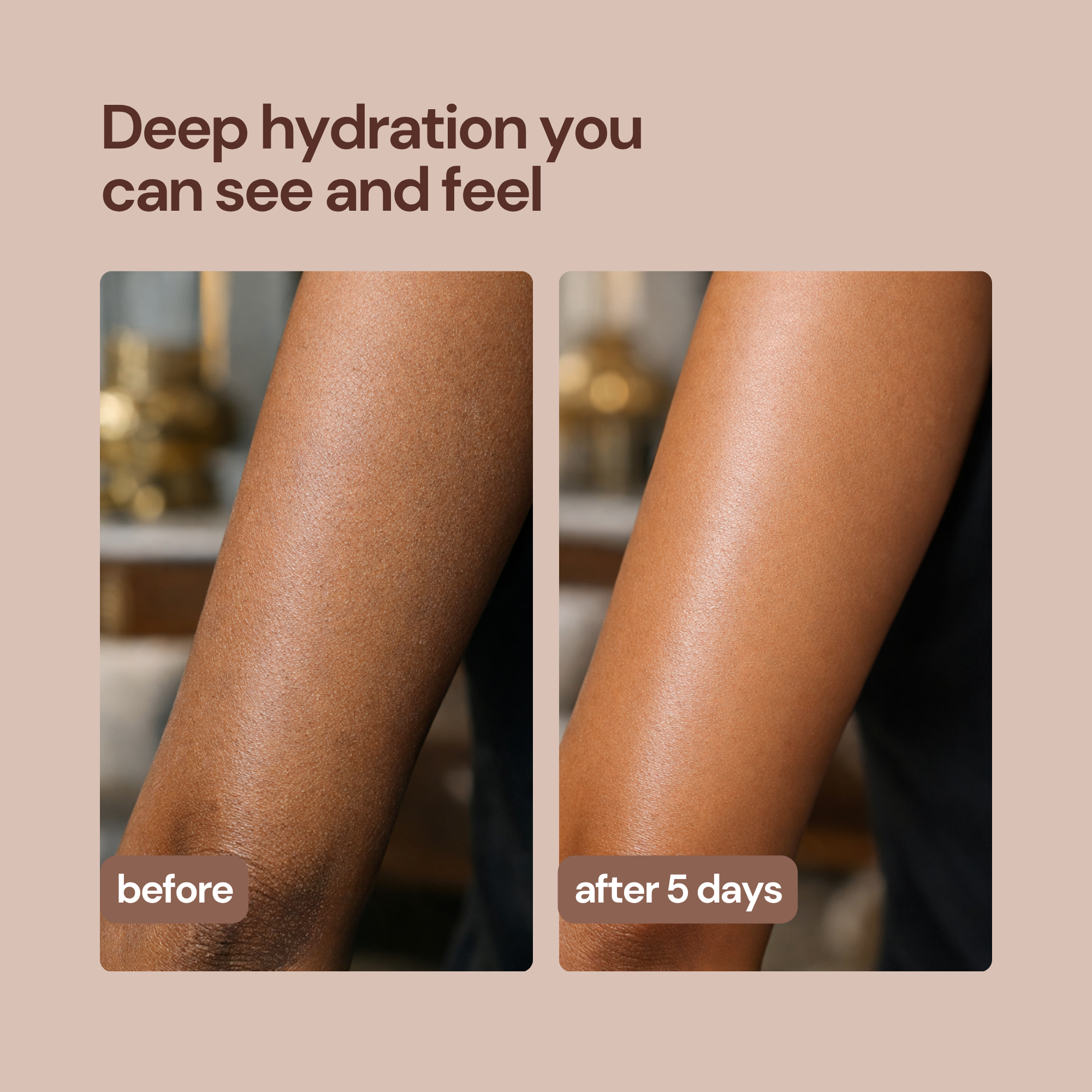 Whipped CremeMatte Body Lotion - Lightweight & Quick-Dry