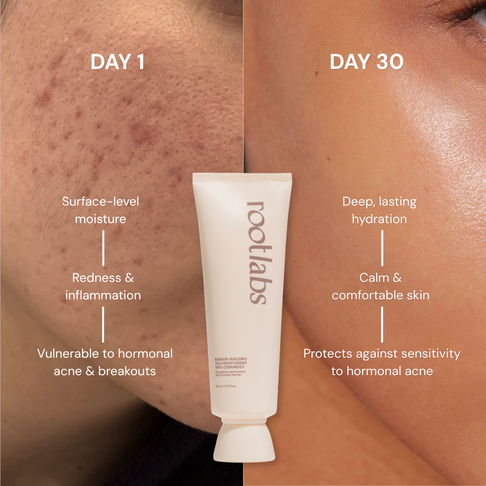 Barrier-Building Face Moisturiser With 3% Ceramide Beads