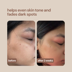 360° Depigmentation Serum With Fermented Honey