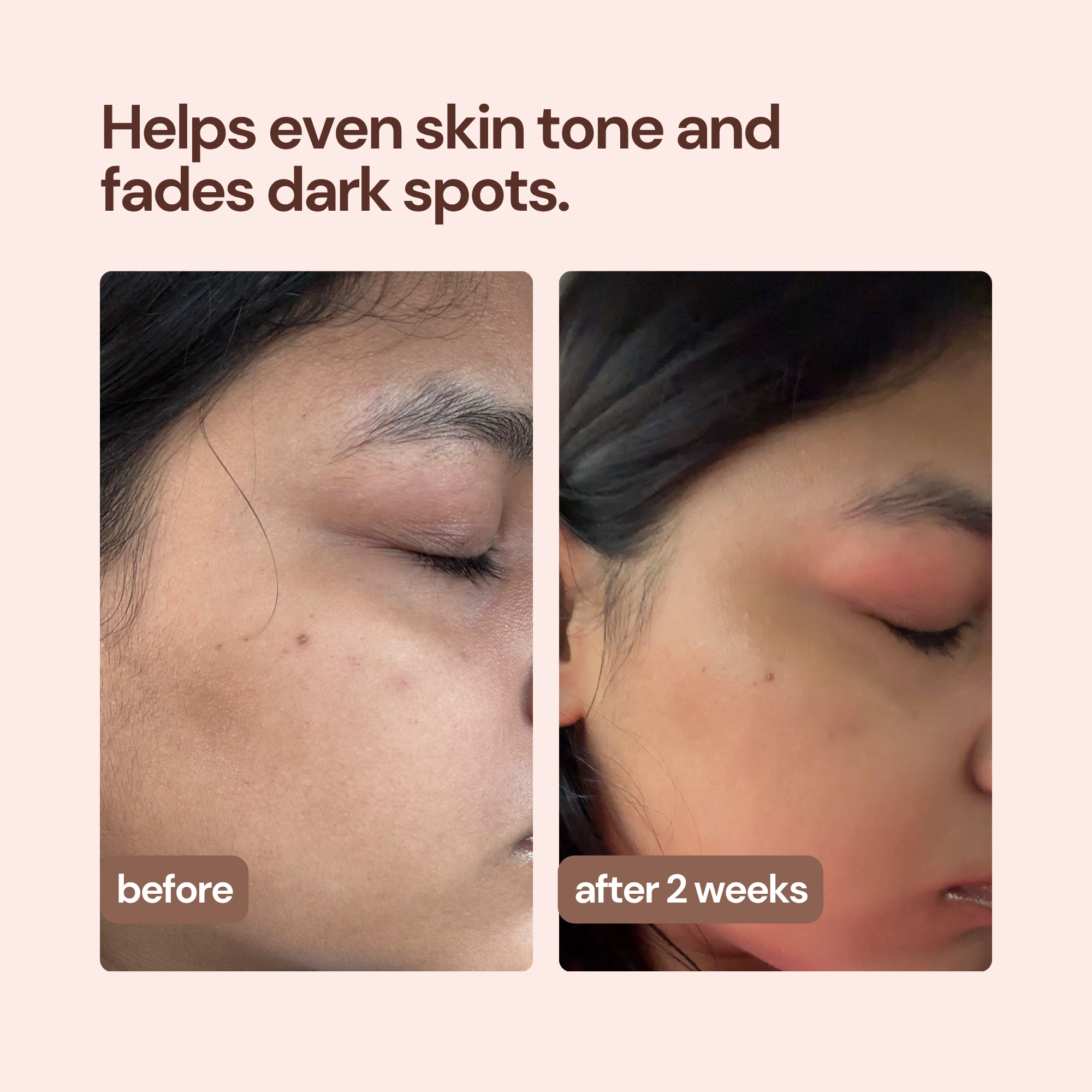 360° Depigmentation Serum With Fermented Honey