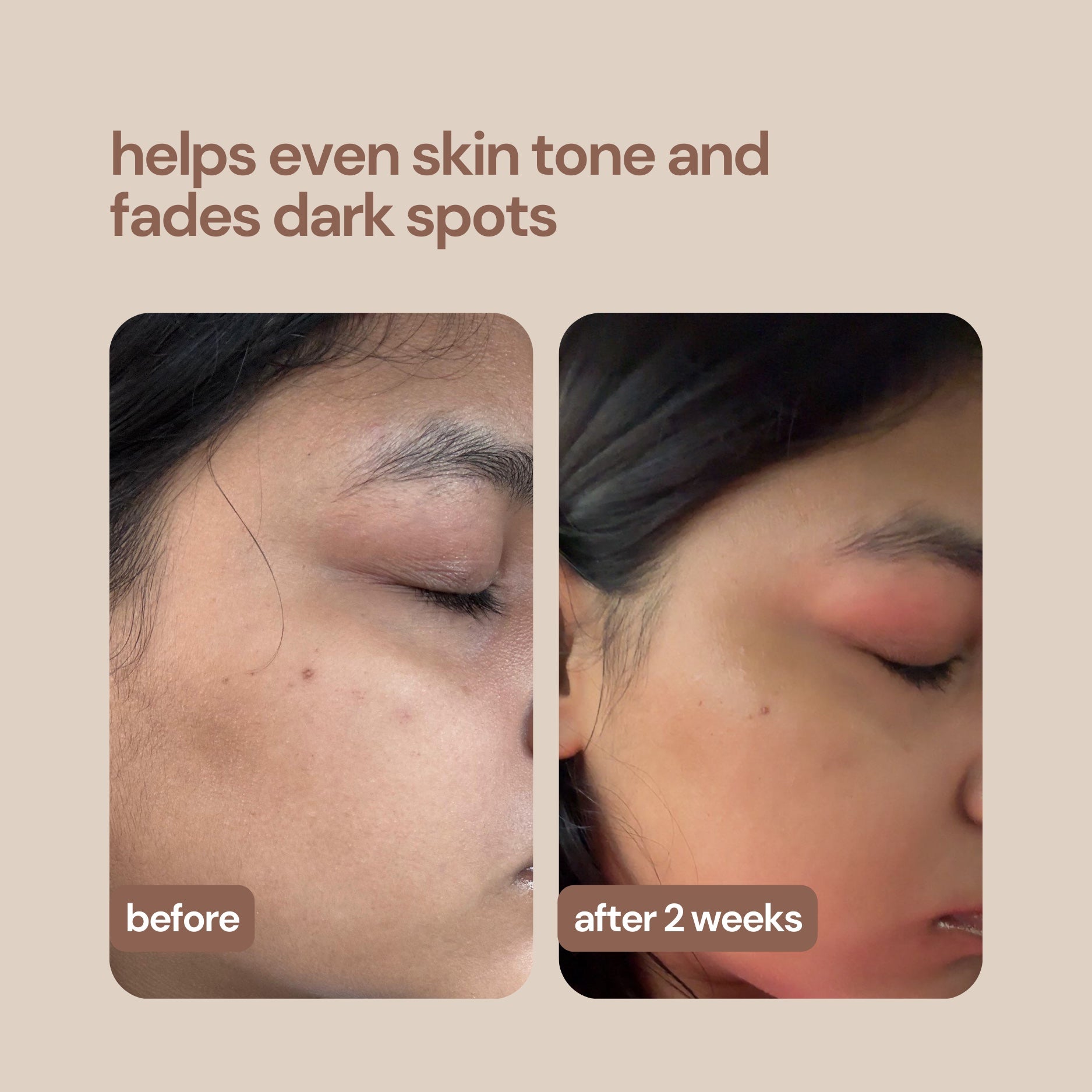 360° Depigmentation Serum With Fermented Honey